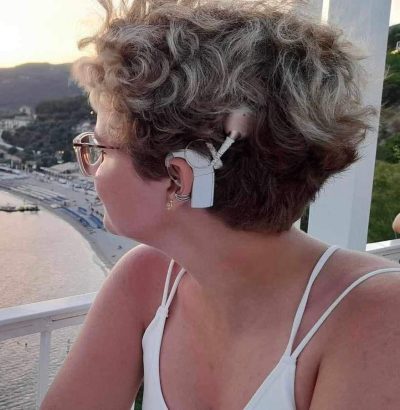 Lily's cochlear implant and hearing aid over her left ear.